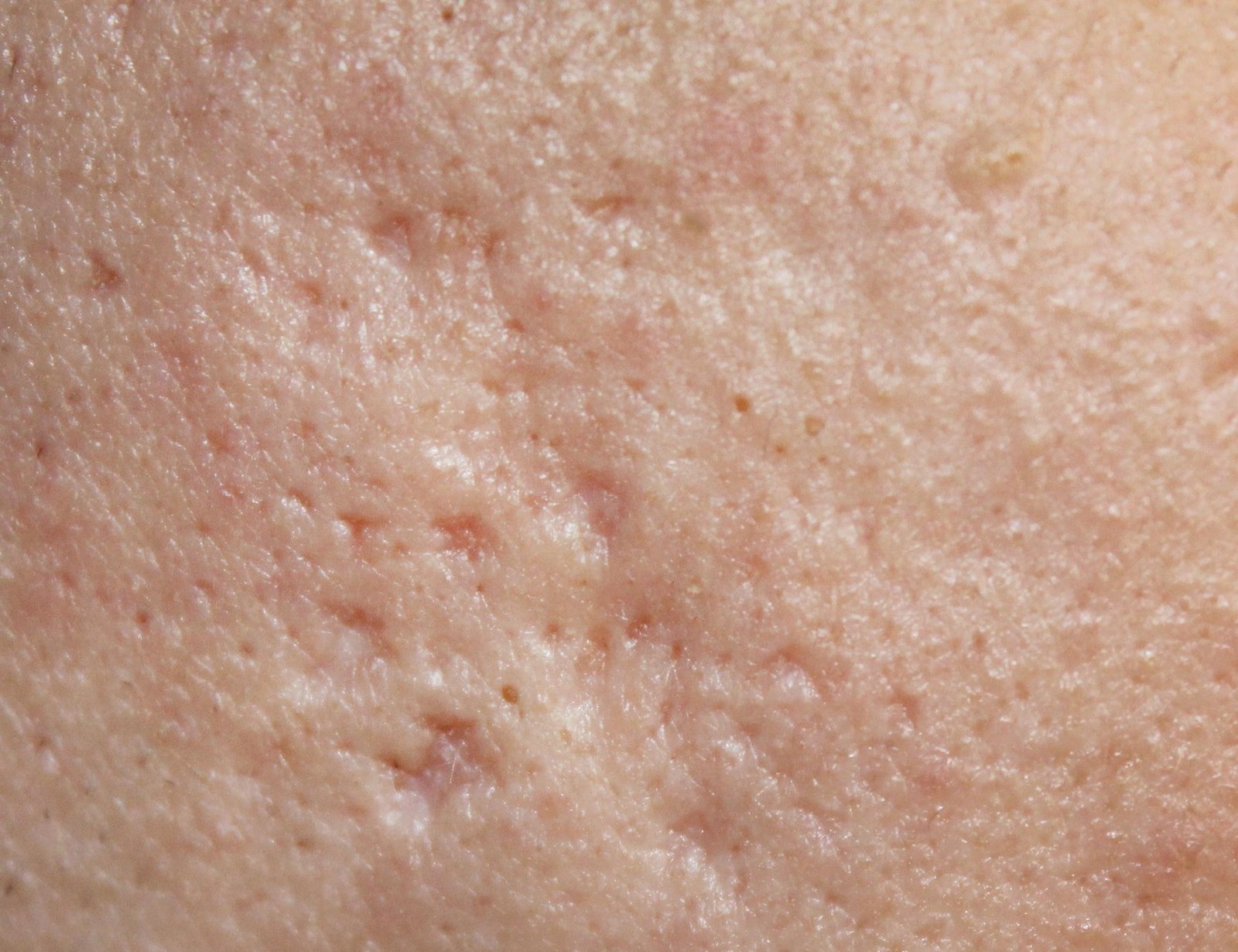 Skin Problem