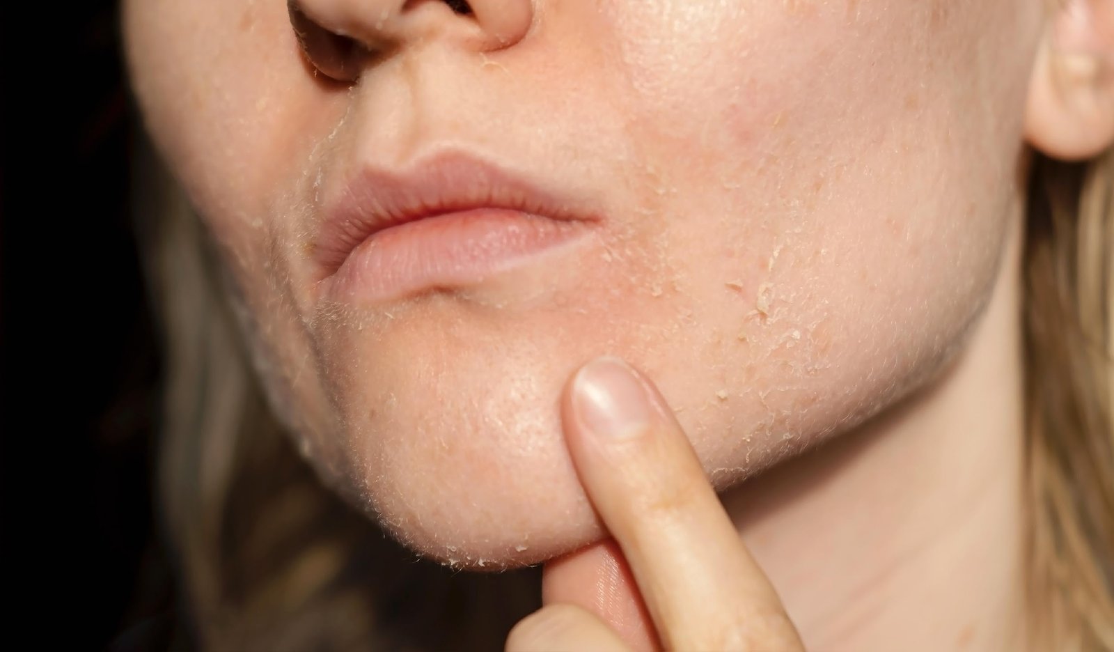 Skin Problem