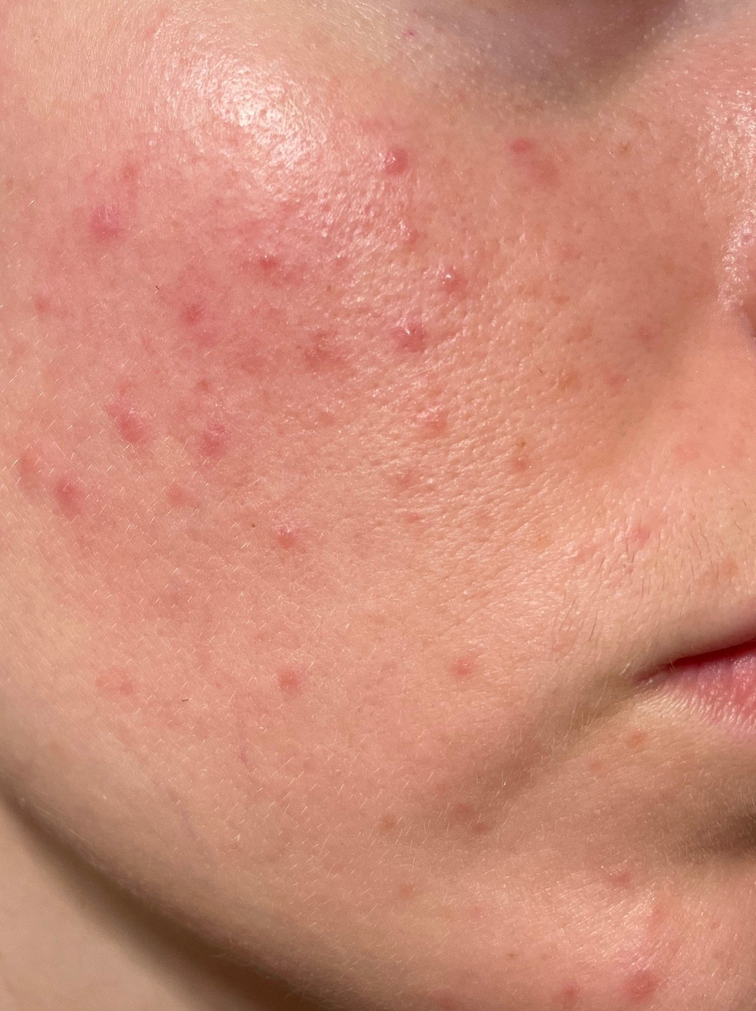 Skin Problem